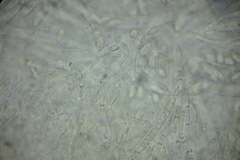 Hymenoscyphus immutabilis