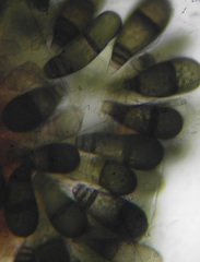 Bactrodesmium obovatum