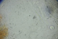 Calonectria pyrochroa