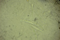 Calonectria pyrochroa