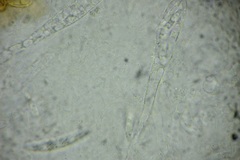 Calonectria pyrochroa