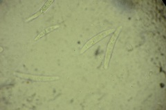 Calonectria pyrochroa