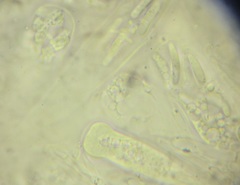 Calosphaeria cryptospora