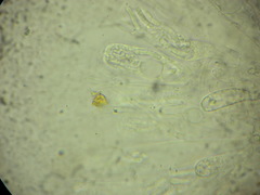 Calosphaeria cryptospora