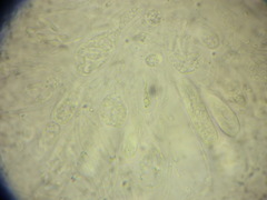 Calosphaeria cryptospora