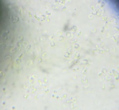 Calosphaeria cyclospora