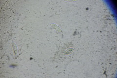 Plagiostoma convexum