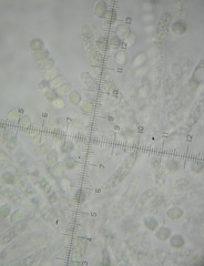 Ovatospora brasiliensis