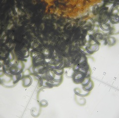 Ovatospora brasiliensis