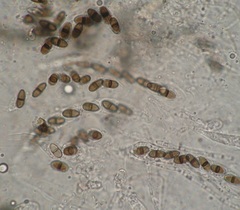 Delitschia marchalii