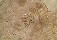 Orthotrichum stramineum