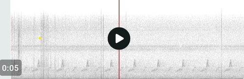 Eastern Whip-poor-will observed by tgregory74