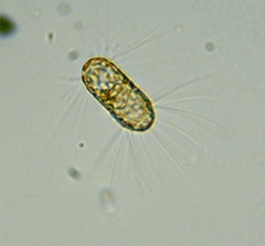 Corethron hystrix