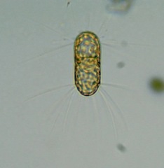 Corethron hystrix