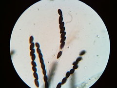 Hypoxylon fuscopurpureum