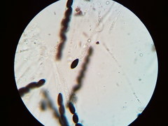 Hypoxylon fuscopurpureum