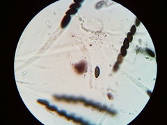 Hypoxylon fuscopurpureum