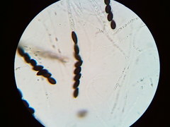 Hypoxylon fuscopurpureum