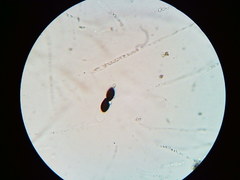 Hypoxylon fuscopurpureum