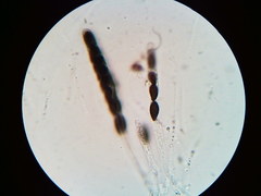 Hypoxylon fuscopurpureum