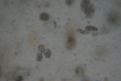 Entomophaga maimaiga