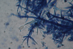 Mycogone calospora