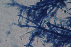 Mycogone calospora