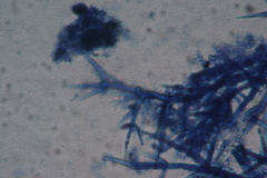 Mycogone calospora