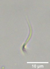 Monoraphidium contortum