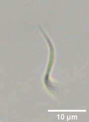 Monoraphidium contortum