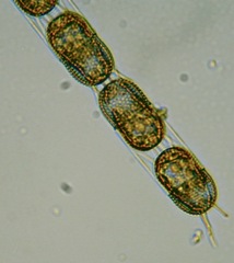 Stephanopyxis nipponica