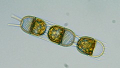 Stephanopyxis nipponica