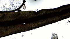 Vinealobryum vineale