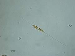 Cylindrotheca closterium