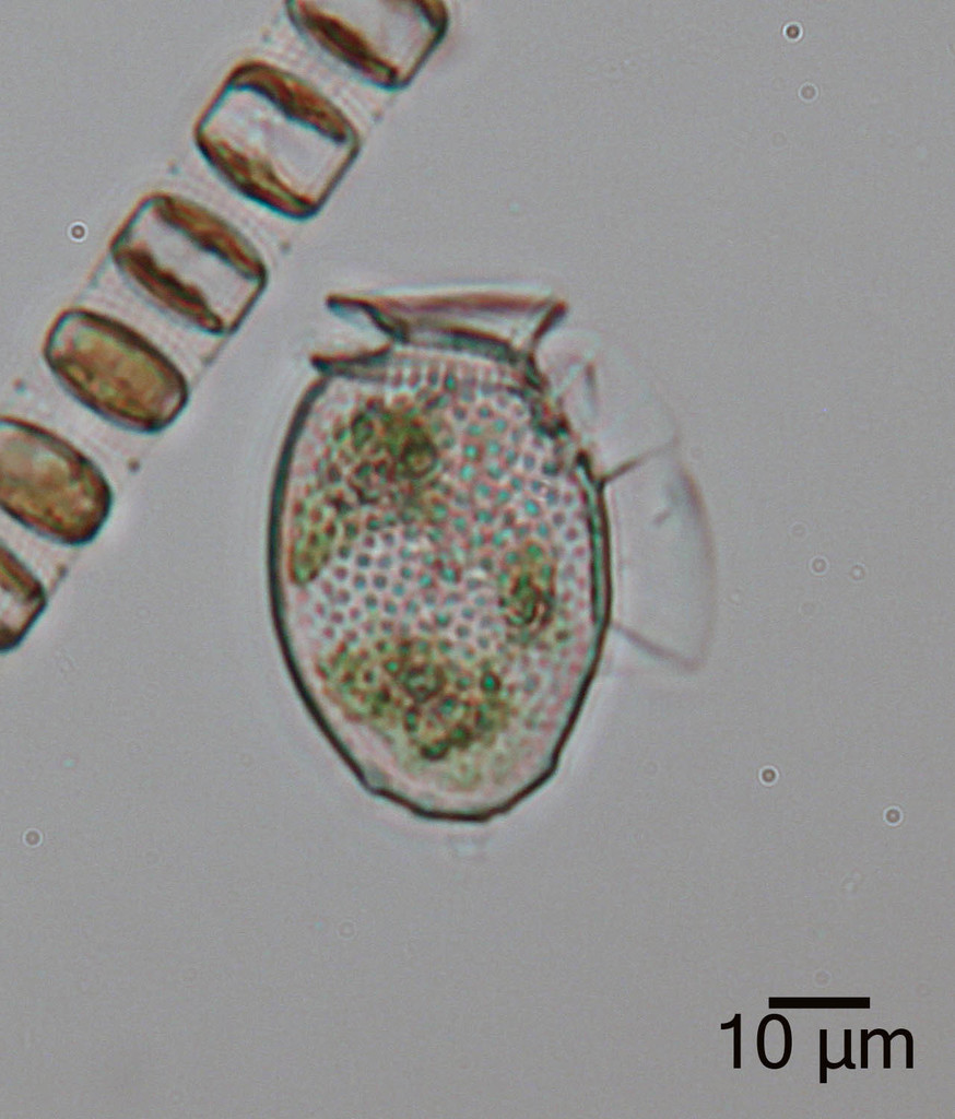 Dinophysis acuminata