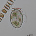 Dinophysis acuminata - Photo (c) Mark Webber, algunos derechos reservados (CC BY-NC), uploaded by Mark Webber