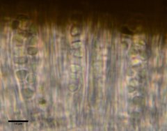 Polycauliona inconspecta