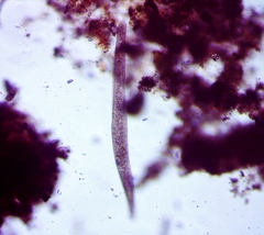 Spirostomum