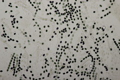 Biscogniauxia nummularia