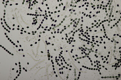 Biscogniauxia nummularia