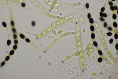 Biscogniauxia nummularia