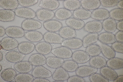 Milesina kriegeriana