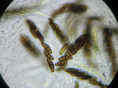 Kalmusia clivensis