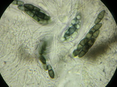 Kirschsteiniothelia atra