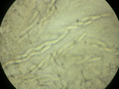 Echinosphaeria strigosa