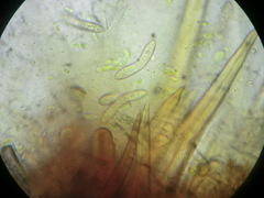 Echinosphaeria strigosa