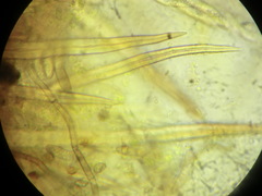 Echinosphaeria strigosa