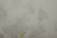 Leptotrochila verrucosa