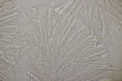 Leptotrochila verrucosa