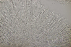 Leptotrochila verrucosa